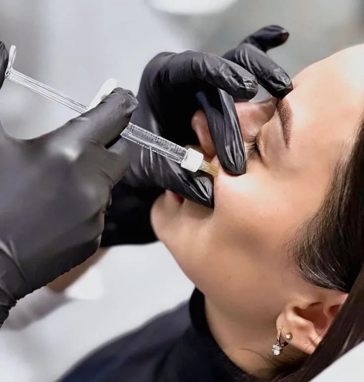 Dermal Fillers (Juvederm, Restylane)