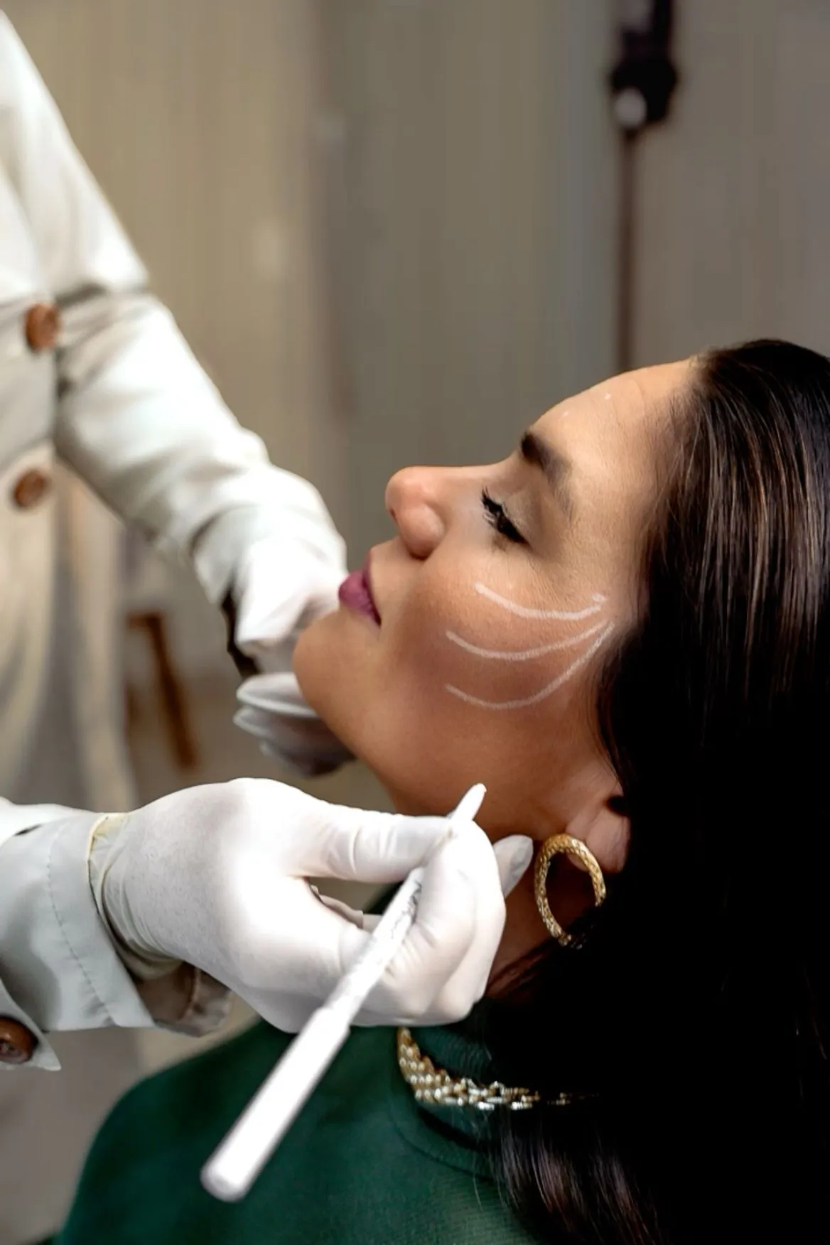 Sculptra Aesthetic
