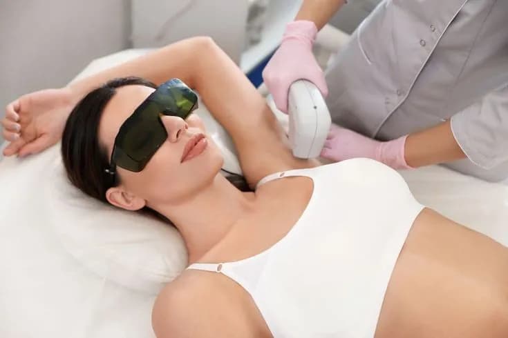 Laser Hair Removal